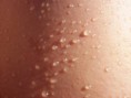 Quel est votre type de peau et comment en prendre soin ?